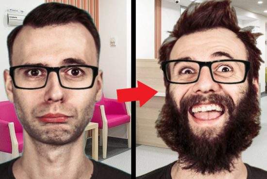 Încă o premieră în România. Unui hipster i-a fost transplantată o barbă, după ce se bărbierise accidental